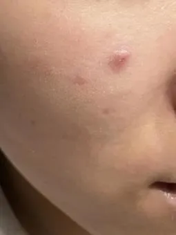 ママの肌荒れが治りにくい理由