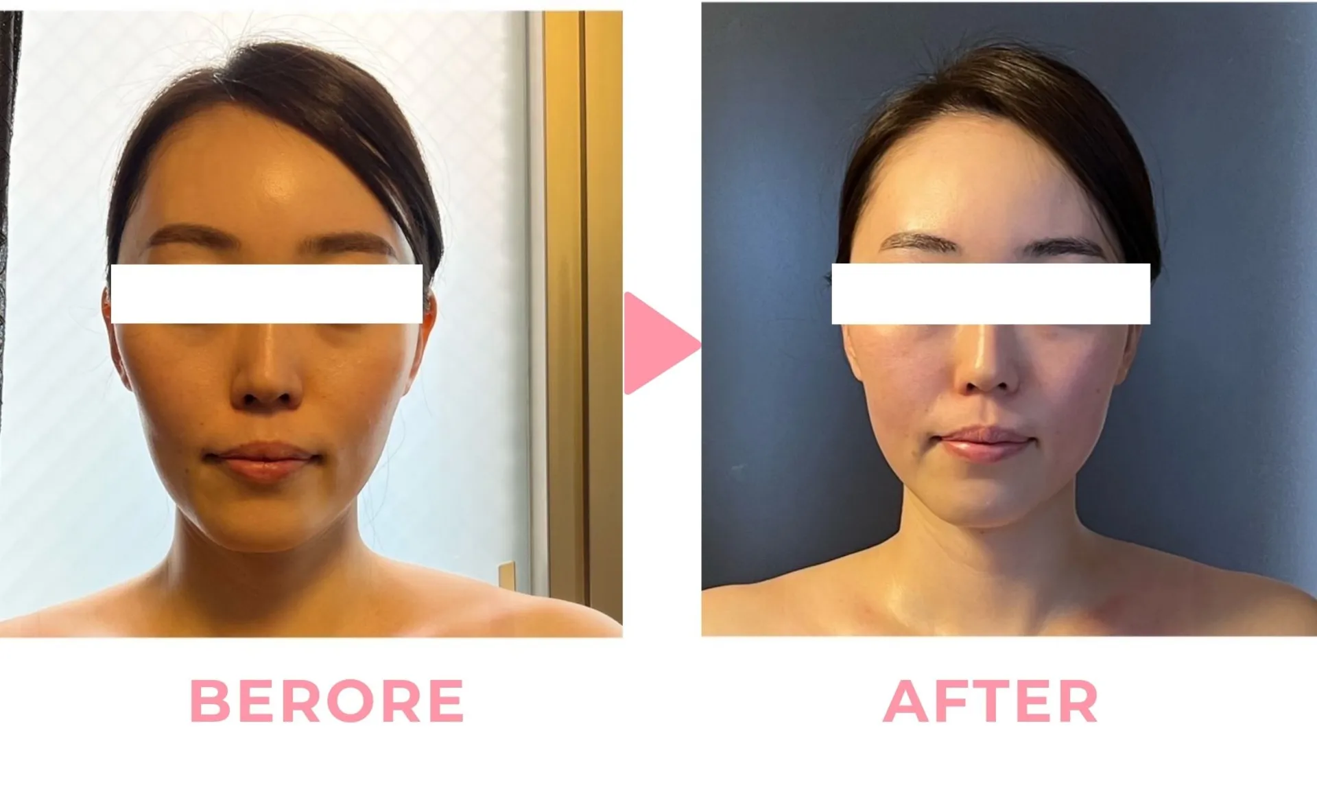 最近、顔の印象が変わったと感じていませんか？